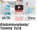 Abdominoplasty/Tummy Tuck