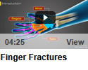 Finger Fractures