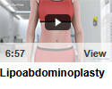 Lipoabdominoplasty