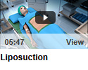 Liposuction