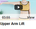 Upper Arm Lift