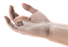 Dupuytren's Contracture