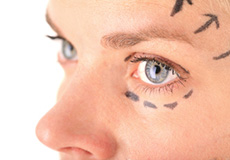 Eyelid & Lacrimal Surgery