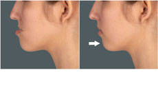 Maxillofacial Surgery